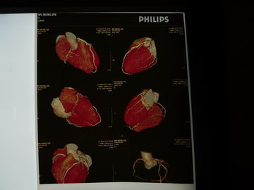 35cm x 43cm医学の乾燥したイメージ投射フィルム、透明物の胸部レントゲンのフィルム