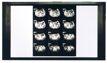 AGFA/富士プリンターのために医学診断レーザーX光線の乾燥したフィルム