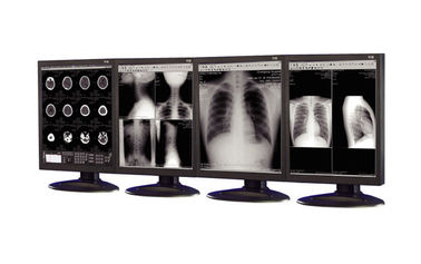 医用画像処理装置で使用される反反射医学等級の表示
