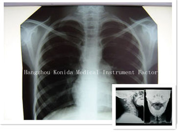 デジタル医学X光線の乾燥したフィルム14 x 17inchの健康イメージ投射レントゲン写真のフィルム