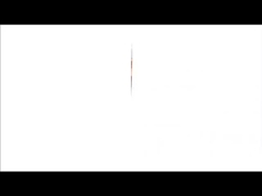 X線熱プリンター