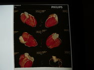 35cm x 43cm医学の乾燥したイメージ投射フィルム、透明物の胸部レントゲンのフィルム
