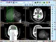 8 x 10inchのKND-DRYTEC 4000のための医学のペーパー レーザーX光線診断イメージ投射