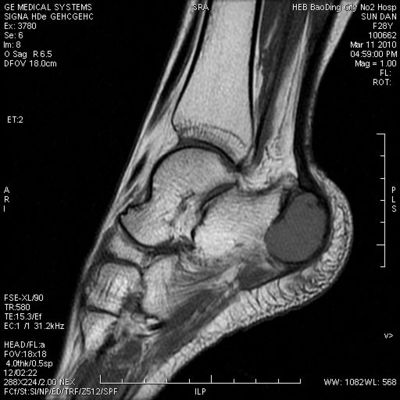 お買い得 KND-Aの高い最高密度サーマル プリンターと互換性がある医学の乾燥したイメージ投射フィルム オンライン