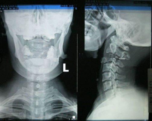 お買い得 高い鋭さのレーザ・プリンタのための身につけられるKonidaの医用画像処理のX線のペーパー オンライン
