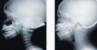 高いインク適用範囲X光線診断イメージ投射、35 x 43cmレーザー医学x光線のフィルム