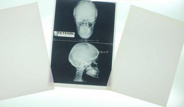 Good price Konida 10in x 12in X光線の医用画像処理 オンライン