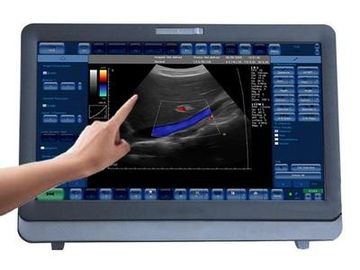 Good price 15インチLEDのモニターが付いている医学3D/4D色のドップラー超音波システム ポータブル オンライン