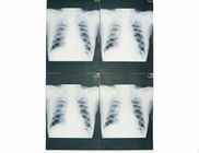 ソニー/EPSONのレーザ・プリンタのためにMoistureproof白い基礎医学X光線のペーパー フィルム