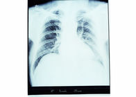 10 x 14のX線富士プリンターのための医学の乾燥したイメージ投射 フィルムの敏感な上昇温暖気流