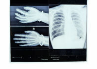 低い霧14in * 17inの医用画像処理の乾燥したX線の透明物のサーマル プリンターのフィルム