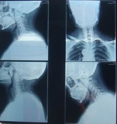 お買い得 KND-Kレントゲン写真の検査のための傷抵抗力がある医学のペーパー乾燥したイメージ投射フィルム オンライン