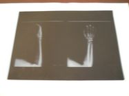 KND-Aの低い霧AGFA 5300 11inの× 14inのX光線の検査のための医学の乾燥したイメージ投射フィルム