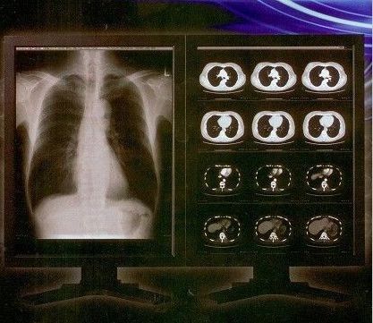 明るく明確なデジタルX光線のフィルム、Konida医学レーザーの透明物のフィルム