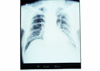 Konida乾燥したイメージ投射フィルム、医学のペーパー レーザー イメージ投射フィルム
