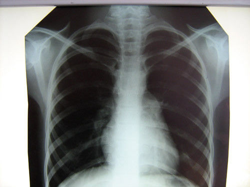 病院のサーマル プリンターが付いている明確な医学のX線フィルムKonida
