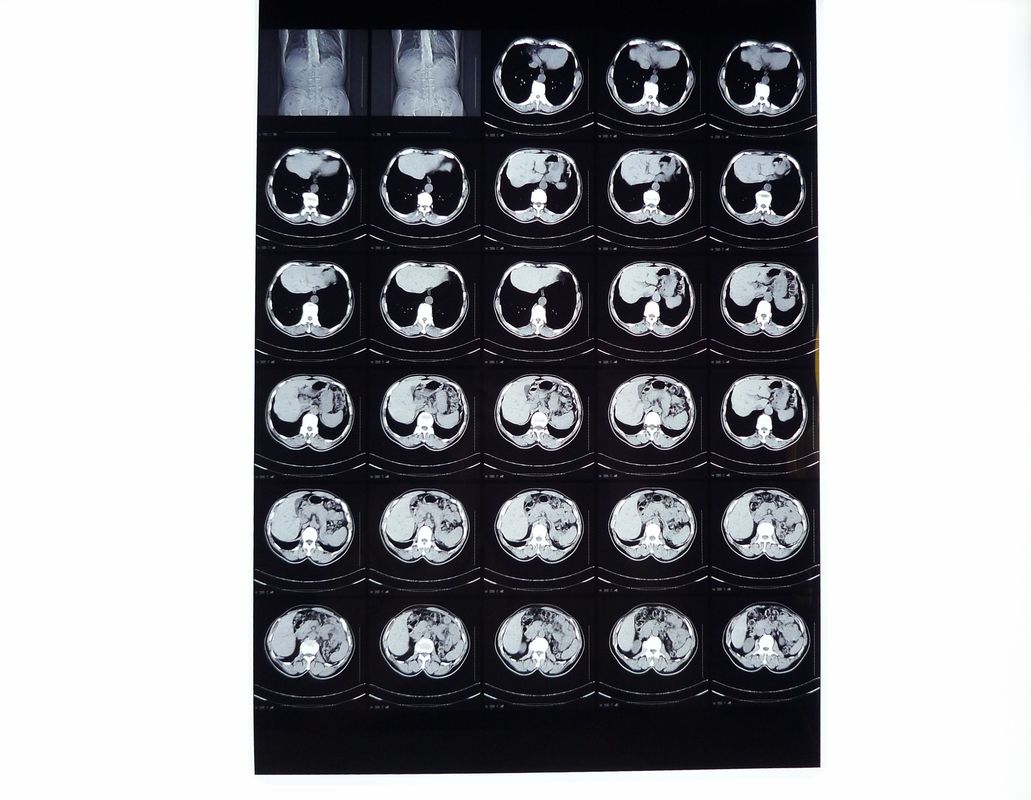 医学X光線のフィルム、CT/DR/MRIのためのサーマル プリンターと互換性がある乾燥したイメージ投射フィルム