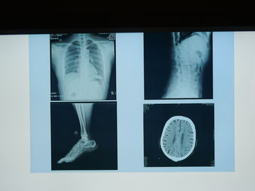 Agfaプリンターのために防水Konida X光線の医用画像処理のフィルム