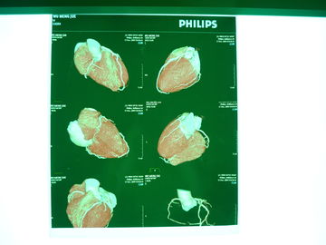 医学のデジタルX光線の乾燥したフィルム、Dt2b/Dt1b Agfa医学の乾燥したイメージ投射フィルム