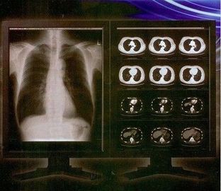 Good price 明るく明確なデジタルX光線のフィルム、Konida医学レーザーの透明物のフィルム オンライン