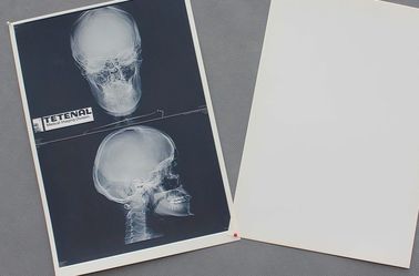 Good price 白い医学のペーパー箱X光線のフィルムの防水高い鋭さ オンライン