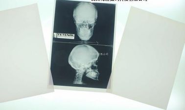 Good price レーザ・プリンタのためのDegradable白い基礎X線のペーパー医学のフィルム オンライン