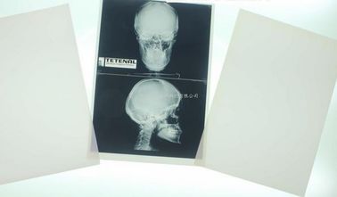 Konidaのレーザ・プリンタのための11 x 14のレーザーの医学の診断イメージ投射