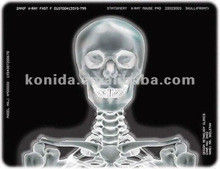 Good price 医療用X線熱プリンターフィルムKND-F25*30cm オンライン