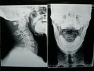 Konida富士/Agfaプリンターのための医学の乾燥したイメージ投射フィルムのデジタルX線