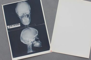 Degradable白い基礎ペット材料X光線のペーパー医学のフィルム