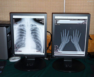 Good price 医学の良質2MP色の医学の表示 オンライン