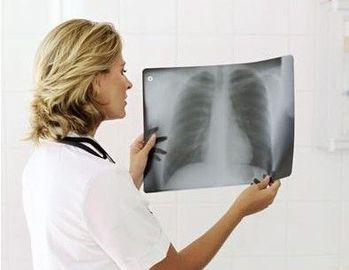 Good price 20 x 25cmレーザー医学の診断イメージ投射フィルムは防水を薄くします オンライン