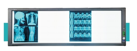 Good price LED医療用超高輝度ビューワーボックス オンライン