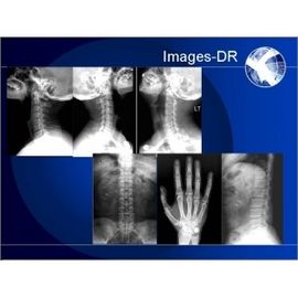 Good price 適用範囲が広いUCの腕を搭載するMammogrpahyのX線のデジタル レントゲン写真術機械 オンライン