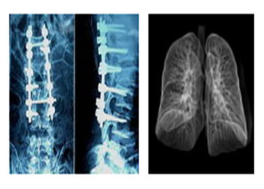 鋭いレントゲン写真の医学X光線のフィルム、Ct Digital Dry Imaging Mriの先生のフィルム