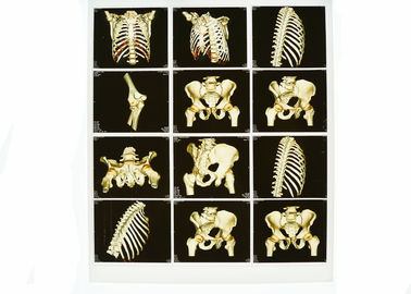 身につけられる白い基盤X光線診断イメージ投射、医学レーザー青いX光線のフィルム