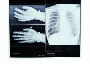 Konida富士/Agfaプリンターのための医学の乾燥したイメージ投射フィルムのデジタルX線