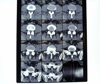 Good price 白いペットAGFA医学の乾燥したフィルム オンライン