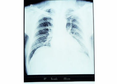 高い鋭さの医学の診断イメージ投射、乾燥したAGFA X光線のフィルム