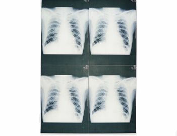 身につけられる白い基礎医学X光線のフィルム、医用画像処理のX線のペーパー フィルム