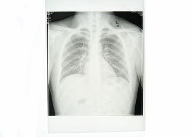 白い医学のペーパー箱X光線のフィルムの防水高い鋭さ