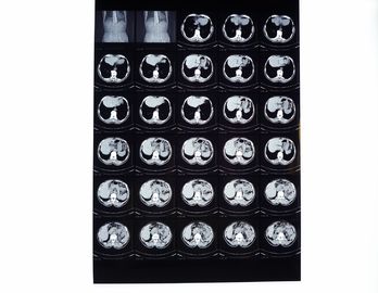 Good price 医学X光線のフィルム、CT/DR/MRIのためのサーマル プリンターと互換性がある乾燥したイメージ投射フィルム オンライン